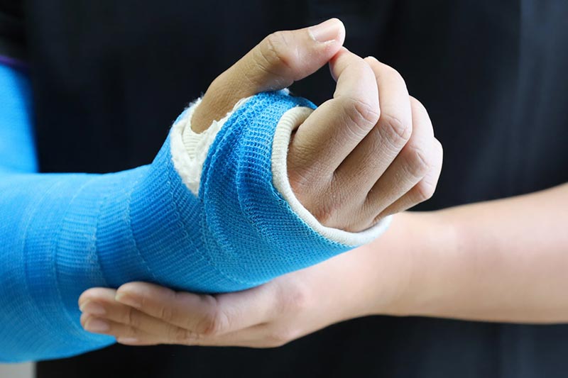 fratura do radio distal entenda a lesao e seu tratamento